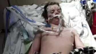 Boy, 13, dies after doing Benadryl Challenge seen on TikTok