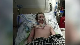 13-year-old dies from ‘Benadryl challenge’ on TikTok, family says