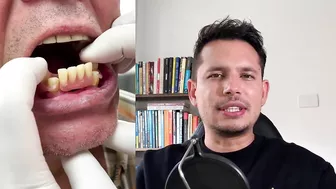 PRÓTESIS DENTAL FLEXIBLE CON DOS DIENTES NATURALES ????????