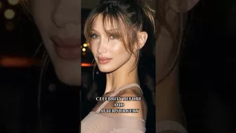 "you're not ugly, you're just poor" #surgery #celebrity #model #shortfeed #beauty #bellahadid