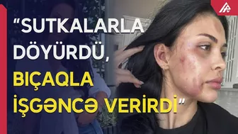 Sevgilisi tərəfindən döyülən model barədə rəsmi açıqlama - APA TV