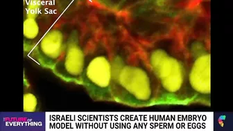 Israeli scientists create human embryo model without using sperm or eggs