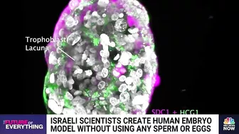 Israeli scientists create human embryo model without using sperm or eggs