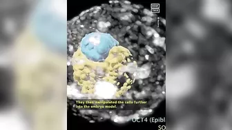 Scientists in Israel Grow Model of Human Embryo