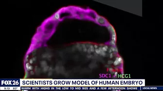 Scientists grow model of human embryo