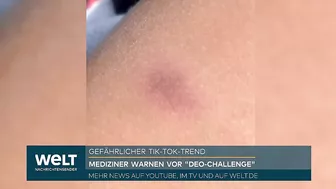 TIKTOK: Atemlähmung, Herzversagen! Neue Deo-Challenge lebensgefährlich - nun reagiert die Plattform