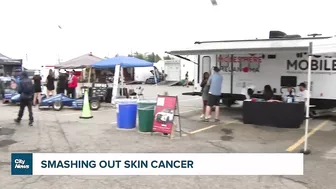 Celebrity fundraiser hoping to help end skin cancer