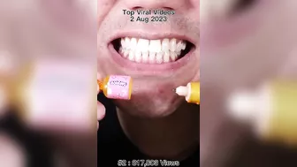 ???? The Daily Champion of Chewing ASMR! #Long #Compilation #ASMR #Satisfying #Best #Viral