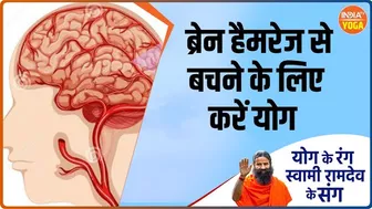 Yoga Tips: ब्रेन हैमरेज के लिए 3 रोग जिम्मेदार ? | Swami Ramdev | Hindi News