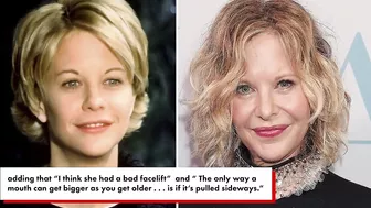 Meg Ryan ‘a mess’ after botched ‘facelift,’ celeb plastic surgeon says