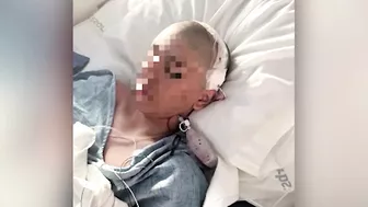 TikTok challenge leaves Madera Unified student with fractured skull