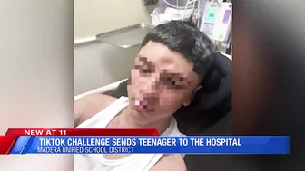 TikTok challenge leaves Madera Unified student with fractured skull