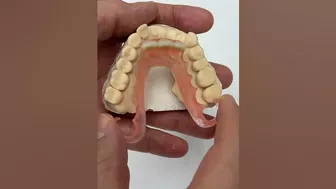 Flexible Partial @EnvisiontecMain #envisiontec #dental #teeth #smile #shorts #shortvideo