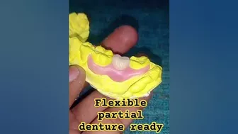 flexible partial denture ready for flask by Ali dental ceramic #removabledenture #partialdenture