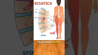 Best Sciatica Pain Relief Yoga Exercise #sciatica #painrelief