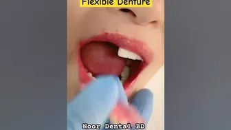 দাঁত বাঁধানো Flexible Denture @DentalHealthTips