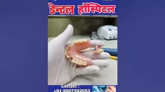 flexible denture . दांत कैसे बनता है।।#dentaltreatment #apna_dental_hospital