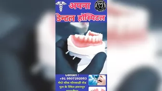 flexible denture . दांत कैसे बनता है।।#dentaltreatment #apna_dental_hospital