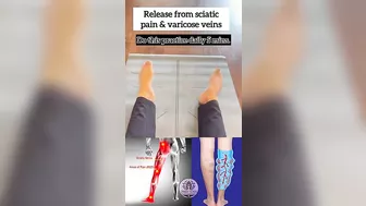 Release from Sciatica pain & Varicose veins! #yoga #youtubeshorts #varicoseveins #sciatica