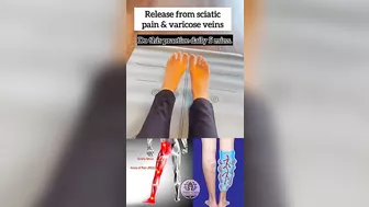 Release from Sciatica pain & Varicose veins! #yoga #youtubeshorts #varicoseveins #sciatica