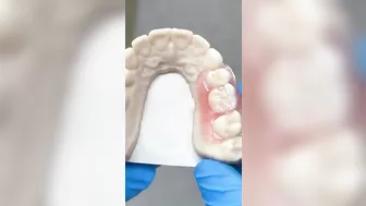 Flexible Nesbit @EnvisiontecMain #envisiontec #dental #teeth #smile #lsk121shorts #shortvideo