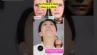 Fix Perioral & Neck LInes in a Week #yoga #mouth #facelift #noticias #nose #antiaging #shorts