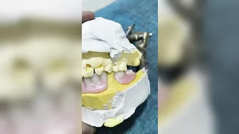 Flexible partial Denture Ready For Try In ????????????#dentures #dentalartbyhaider